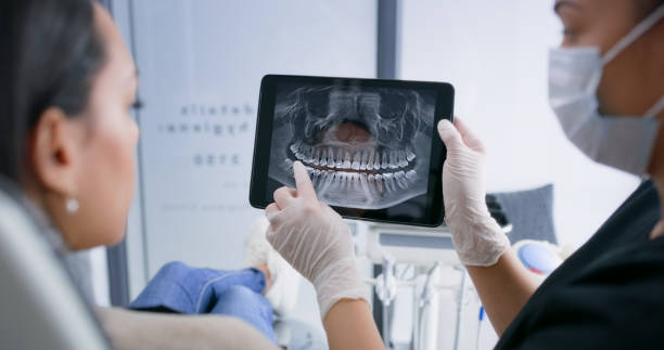Licensed Tooth Extraction service in Olympia, SC - Smile Center Dentistry